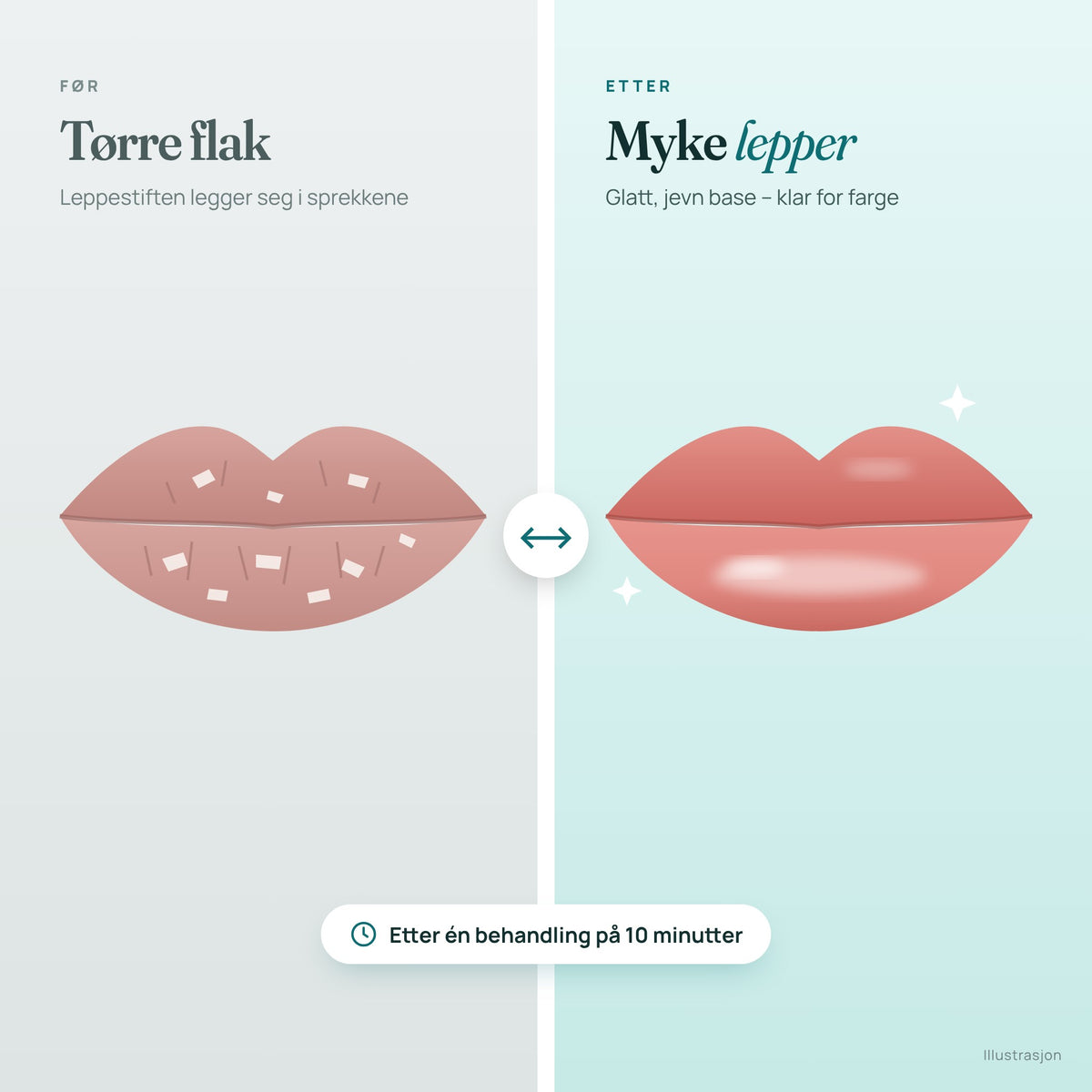 Aquelle™ Peel-off leppemaske – myke lepper på 10 minutter